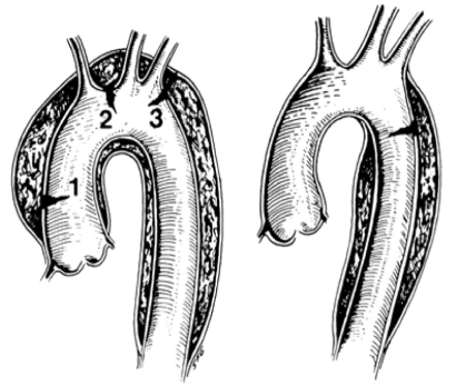 Figure 3)