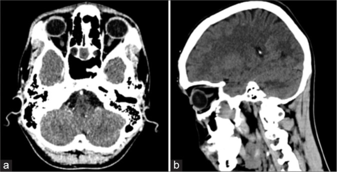 Figure 1: