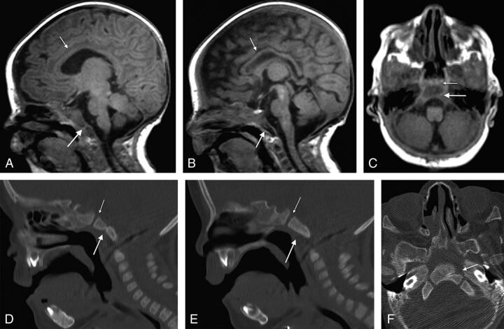 Fig 3.