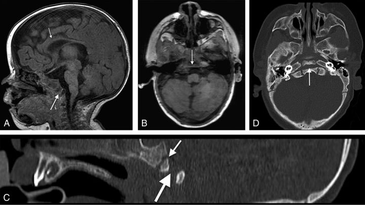 Fig 2.