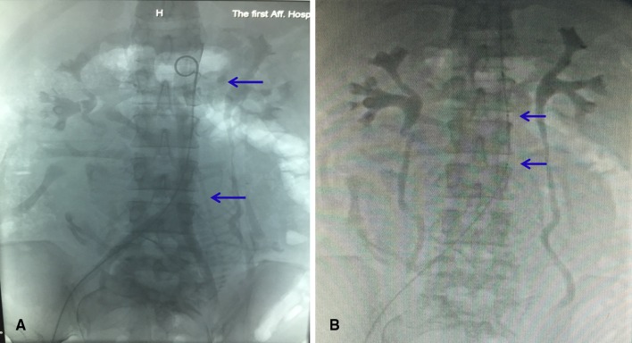 Fig. 1