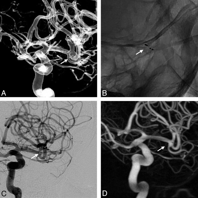 Fig 3.