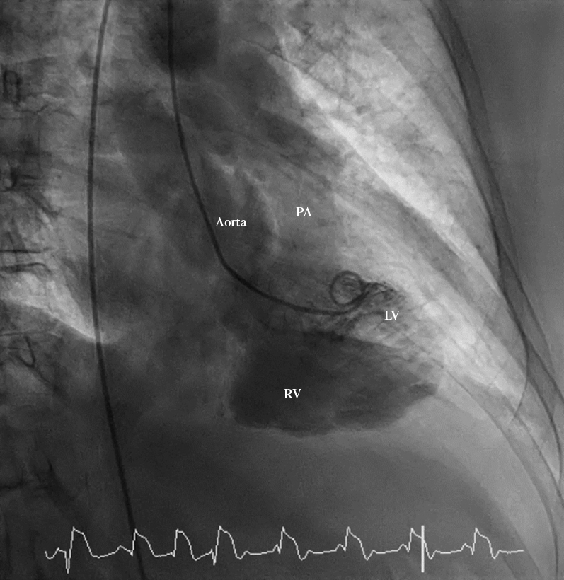 Figure 3