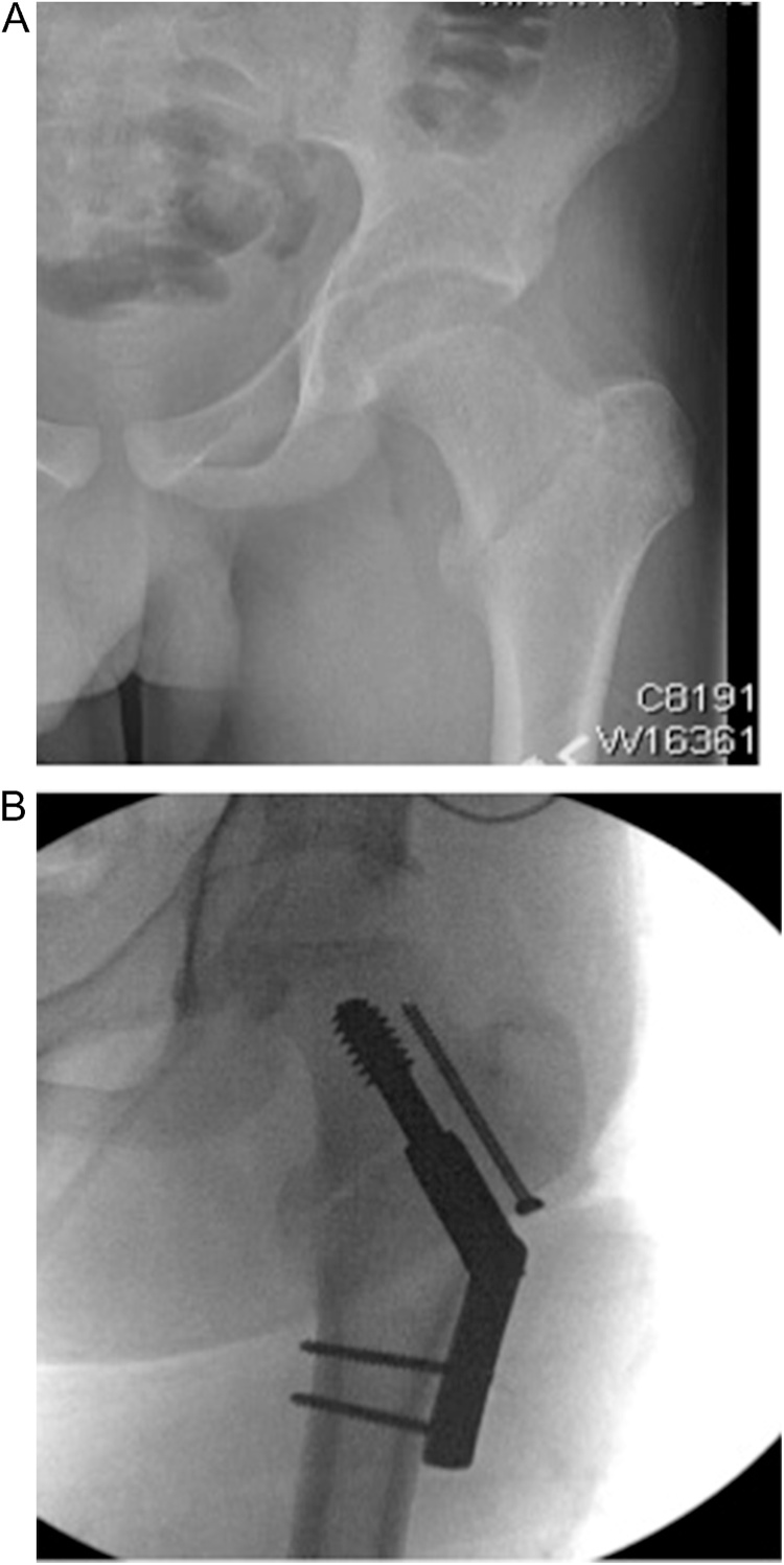 Fig. 6