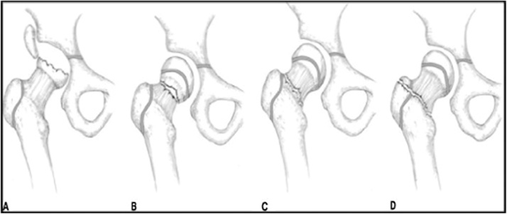 Fig. 2