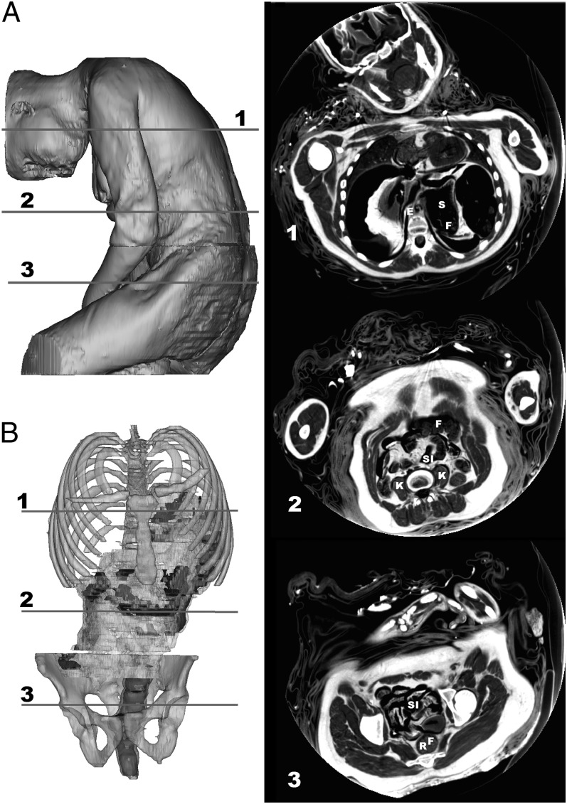 Fig. 3.