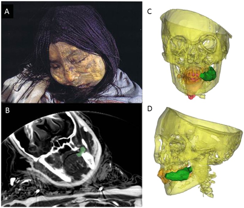 Fig. 4.