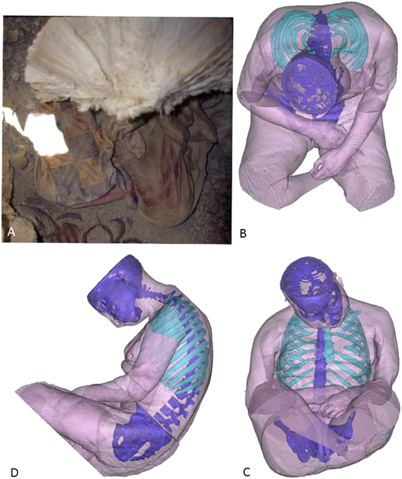 Fig. 1.