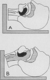 246