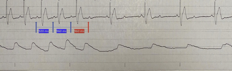 Figure 2