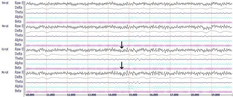 Figure 10