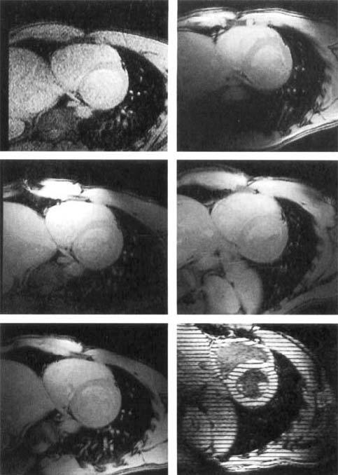 FIG. 6