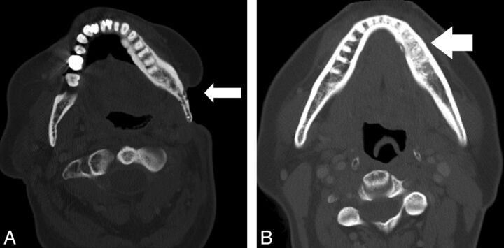 Fig 3.