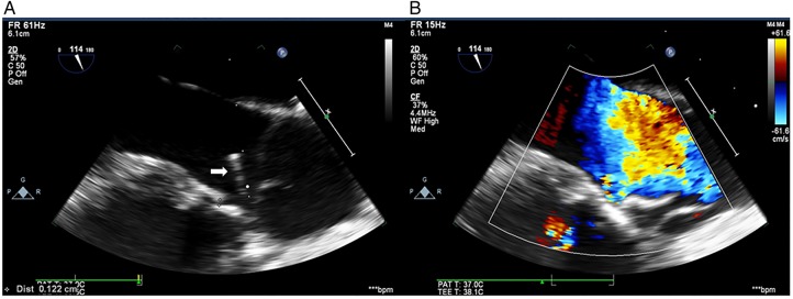 Figure 3