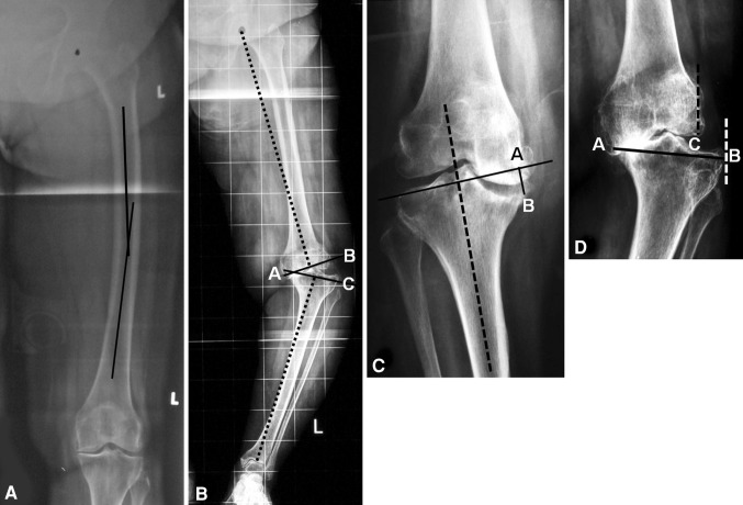 Fig. 1A–D