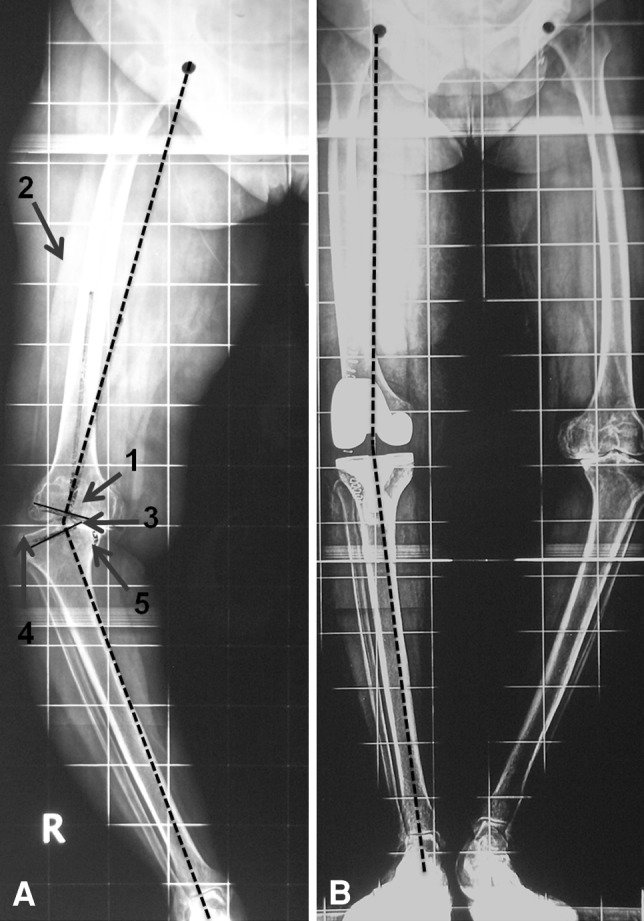 Fig. 3A–B