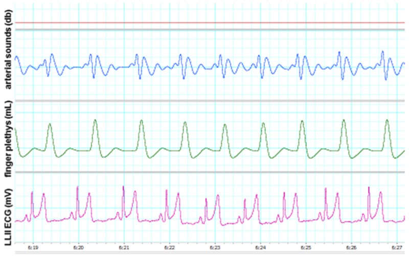 Figure 5