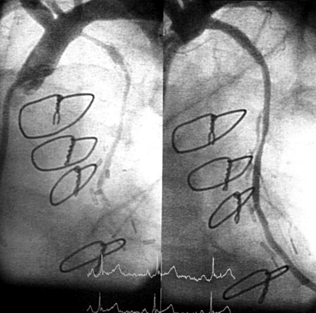 Figure 3  