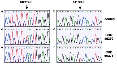 Mutations in the ABCA4 (ABCR) Gene Are the Major Cause of Autosomal ...