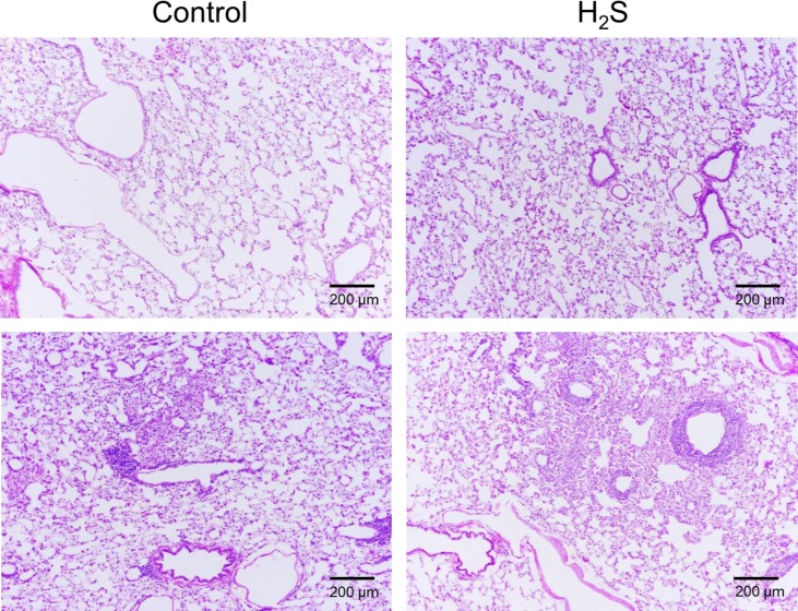 Fig 15