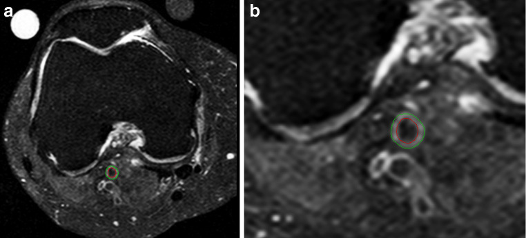 Fig. 1