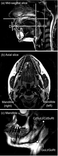 FIG. 2.