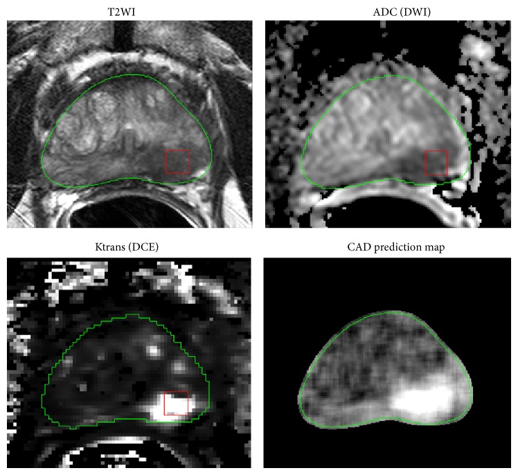 Figure 2