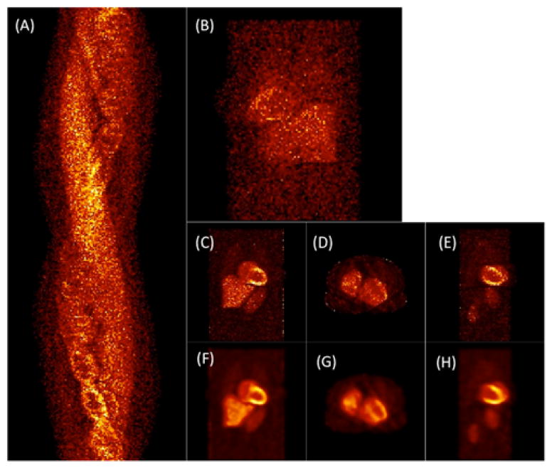 Fig. 15