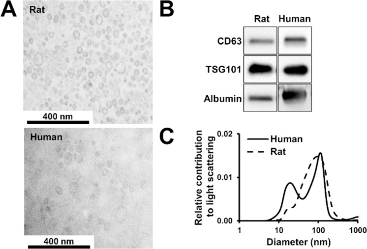 Isolation of Exosomes from Blood Plasma: Qualitative and Quantitative ...