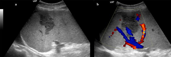 Fig. 11