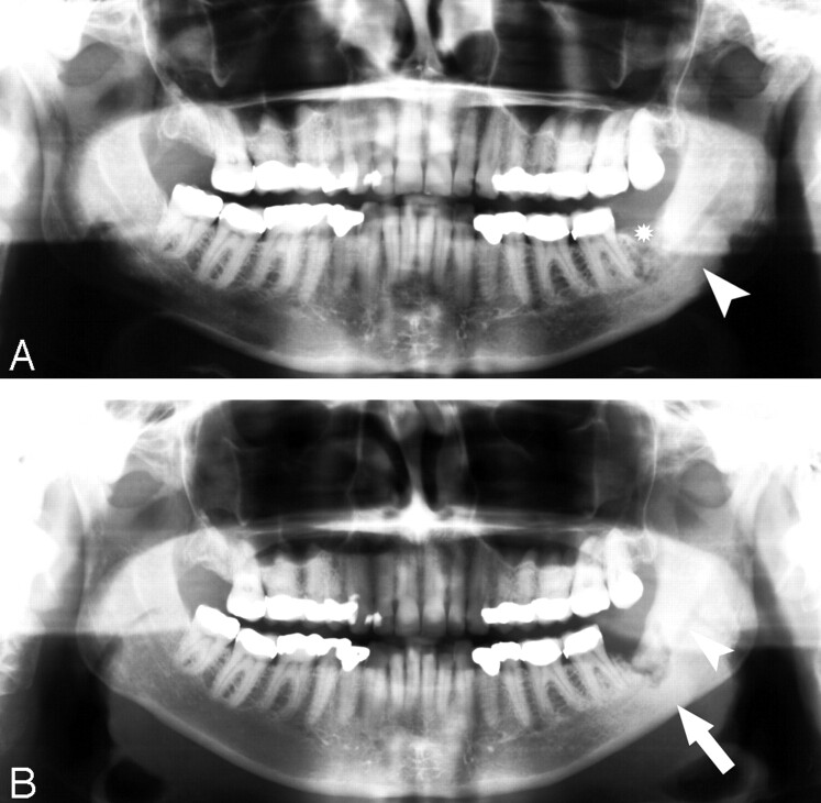 Fig 4.