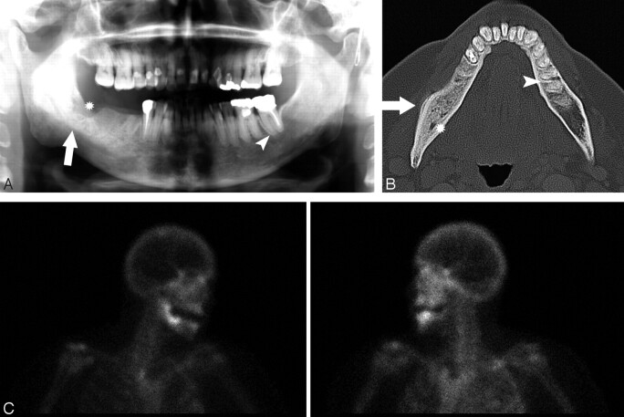 Fig 3.