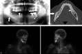 Fig 3.