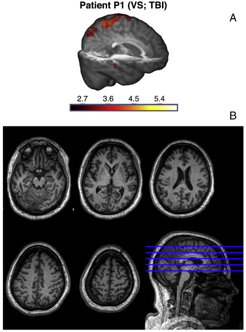 Fig. 4