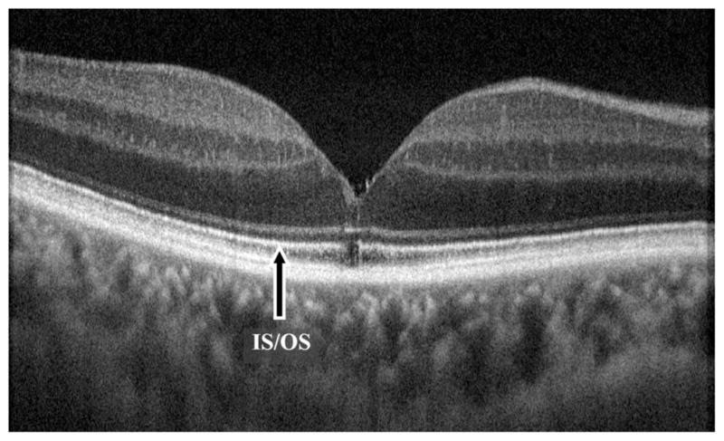 Fig. 4