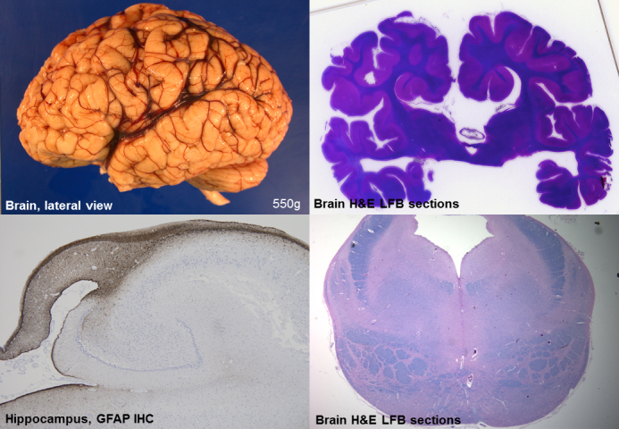 graphic file with name awv393fig1g.jpg