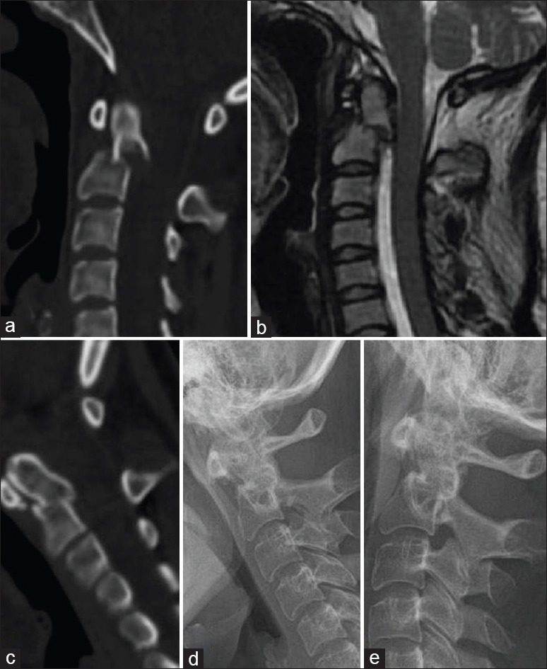 Figure 4