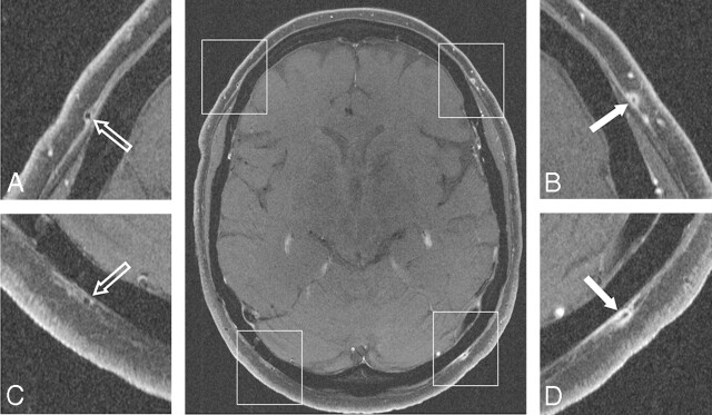 Fig 3.