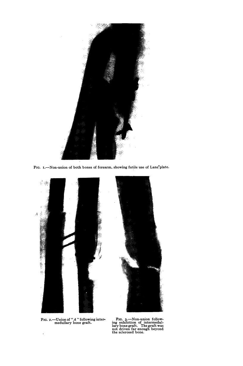 606-1