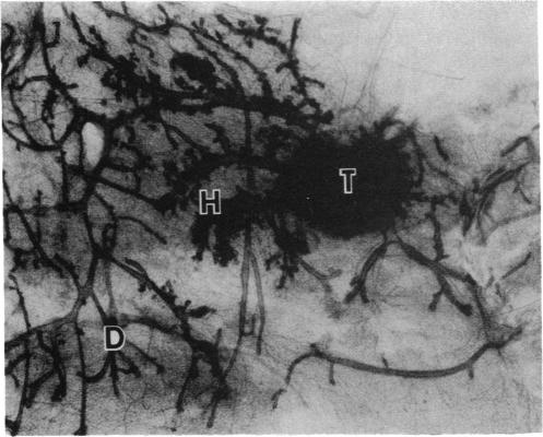 graphic file with name pnas00254-0188-a.jpg