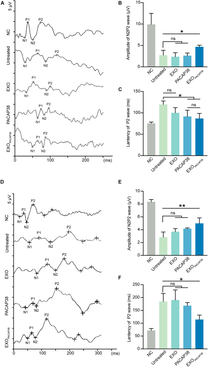 FIGURE 4