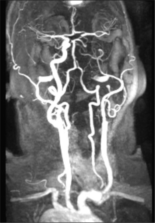 Figure 4: