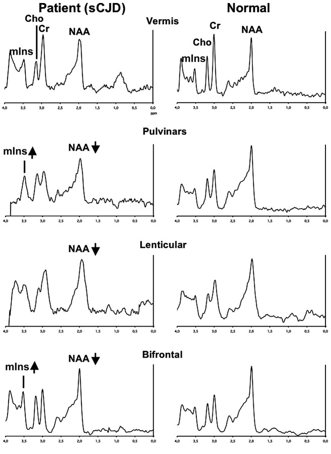 Fig 3.