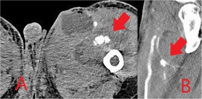 Fig. 19