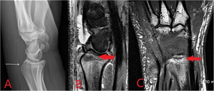 Fig. 11