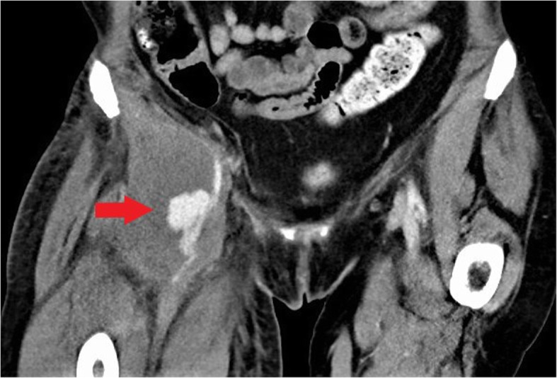 Fig. 18