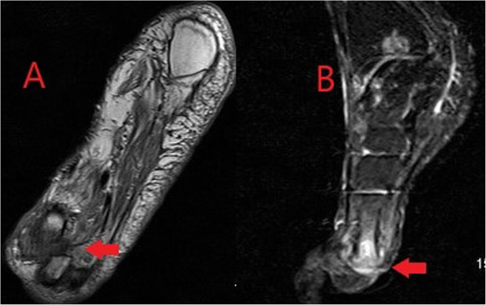 Fig. 15