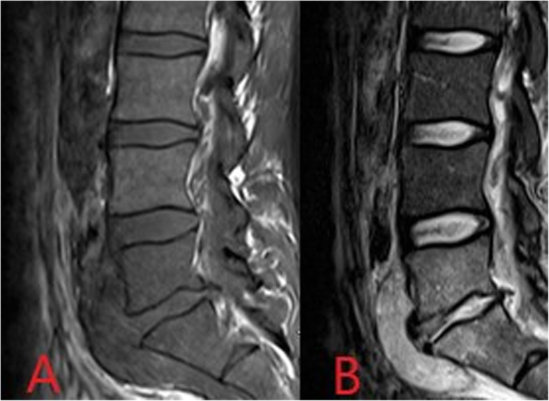 Fig. 13