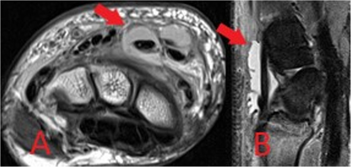 Fig. 12