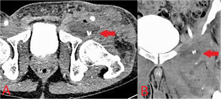 Fig. 8